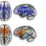 Male and Female differs in their Hard wiring Brain Structures